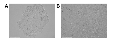 图 1 培养中的未分化诱导多能干细胞(iPSCs)