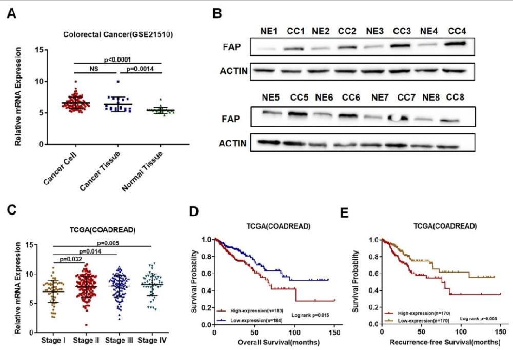 图 1：FAP 在 CRC 细胞中高表达且与不良临床结局相关