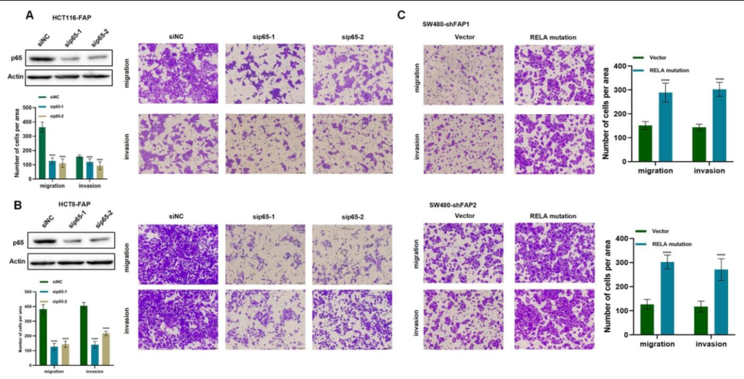 图 5：NF-κB 通路是 FAP 促转移的关键