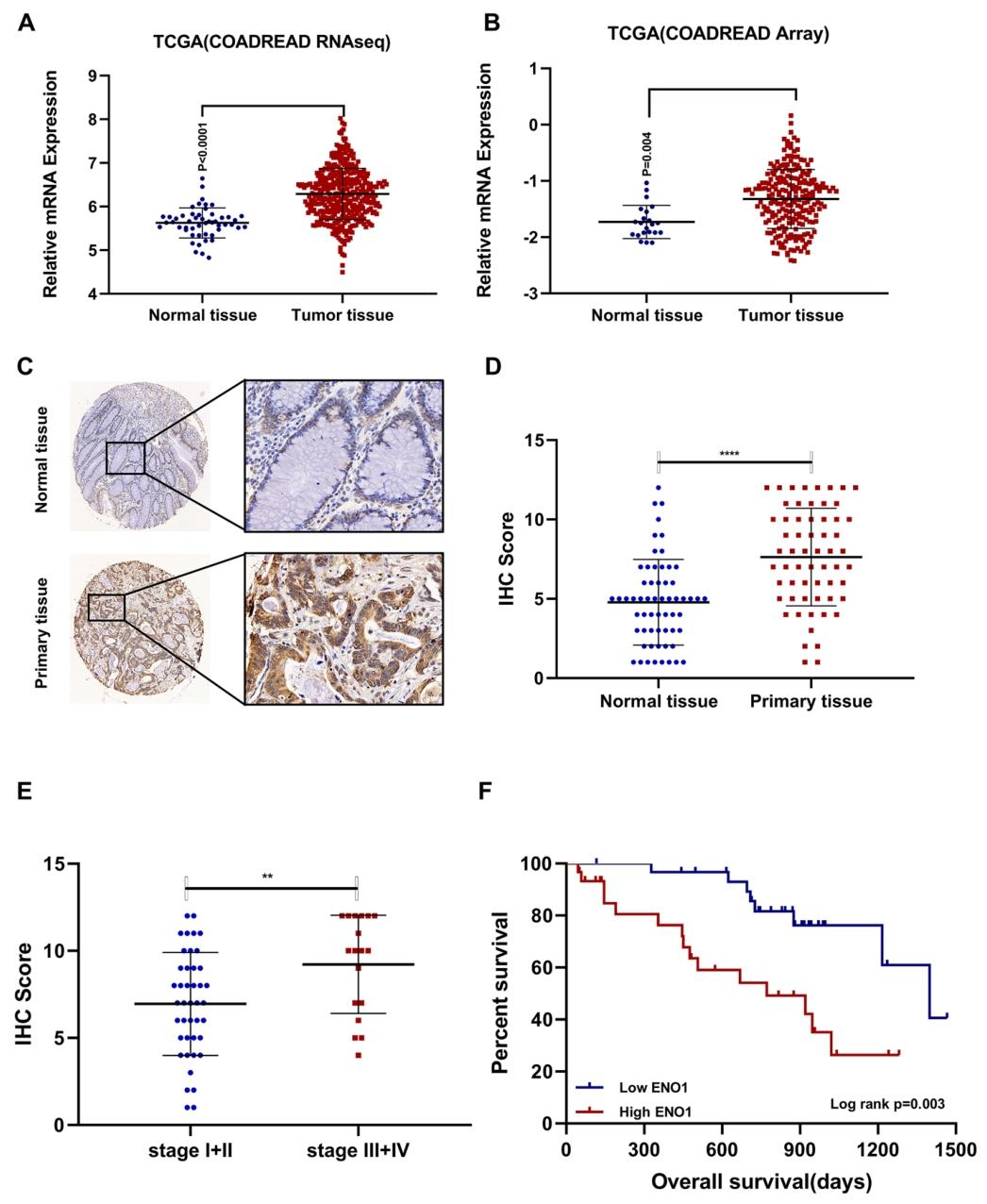 图 8：ENO1 在 CRC 中高表达且与不良预后相关
