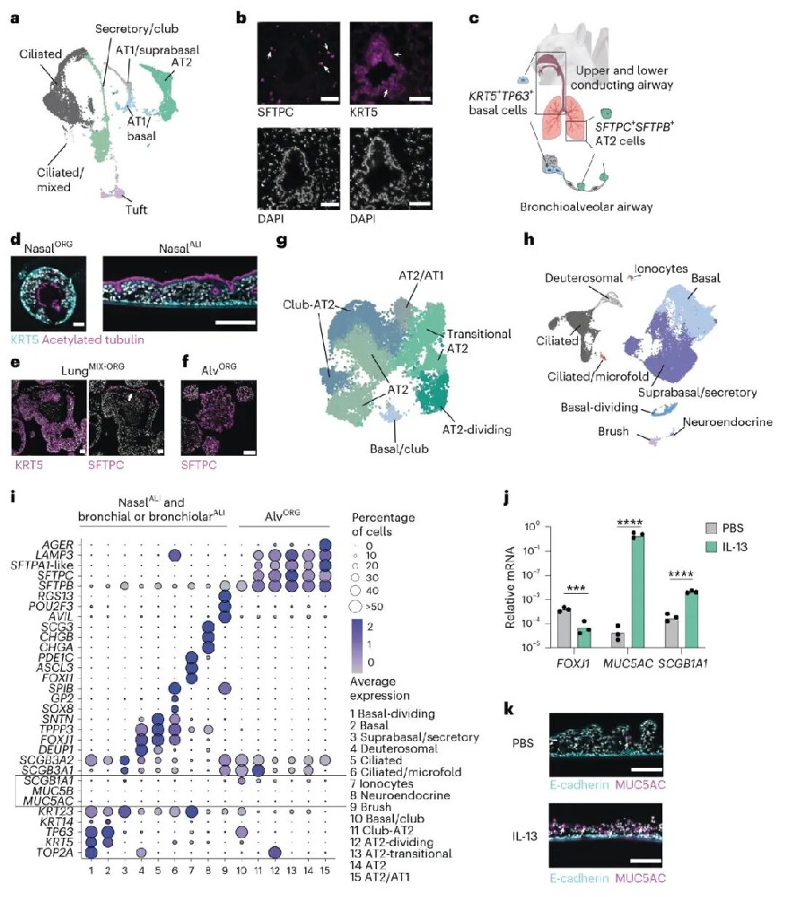 图1 埃及伊蚊鼻腔、支气管和肺泡气道类器官含有多种细胞类型