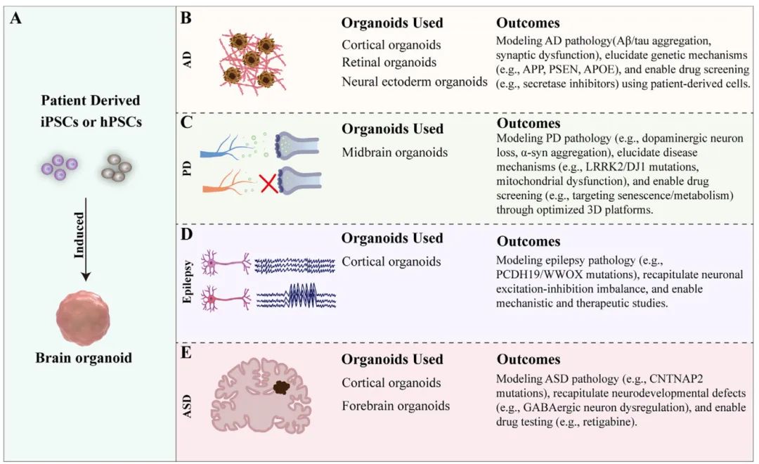 图4 脑类器官在神经疾病模型中的应用