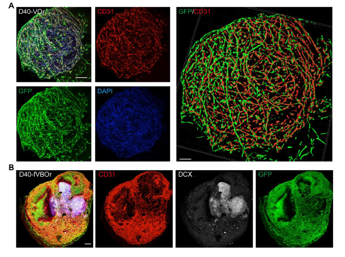 图 2 通过细胞标志物染色对血管类器官(VOrs)和融合血管化脑类器官(fVOrs)进行鉴定