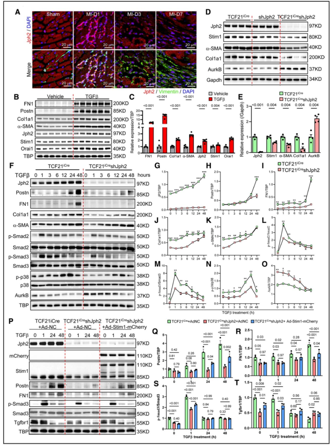 图 5：Jph2 是 CFs 激活、分化及 TGFβ 信号响应所必需