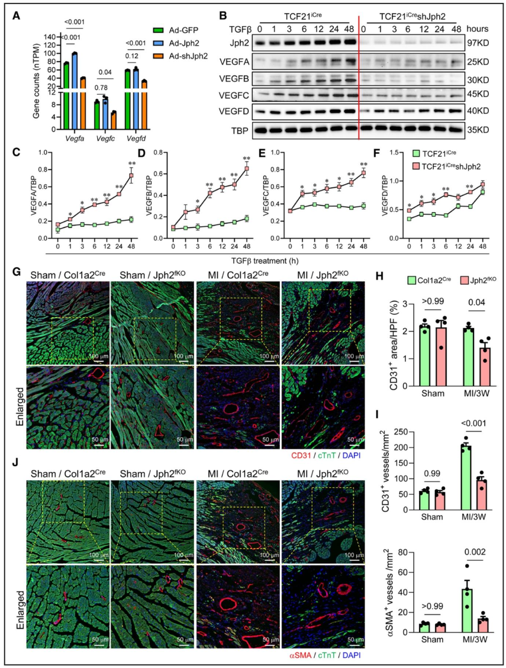 图 7：Jph2 在 MI 后心脏血管生成中起关键作用