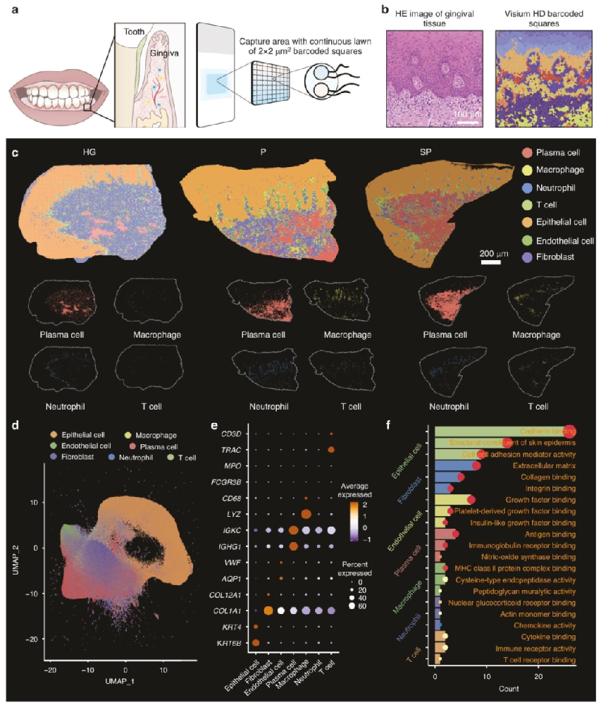 图 1：人牙龈组织单细胞分辨率空间转录组图谱的构建