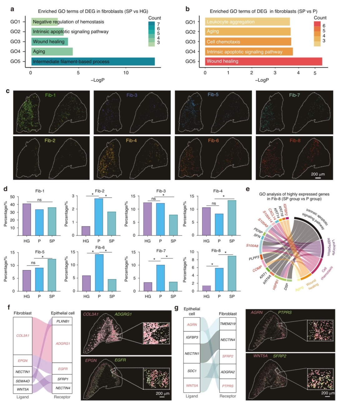 图 3：吸烟诱导成纤维细胞改变及成纤维细胞 - 上皮细胞通讯失调