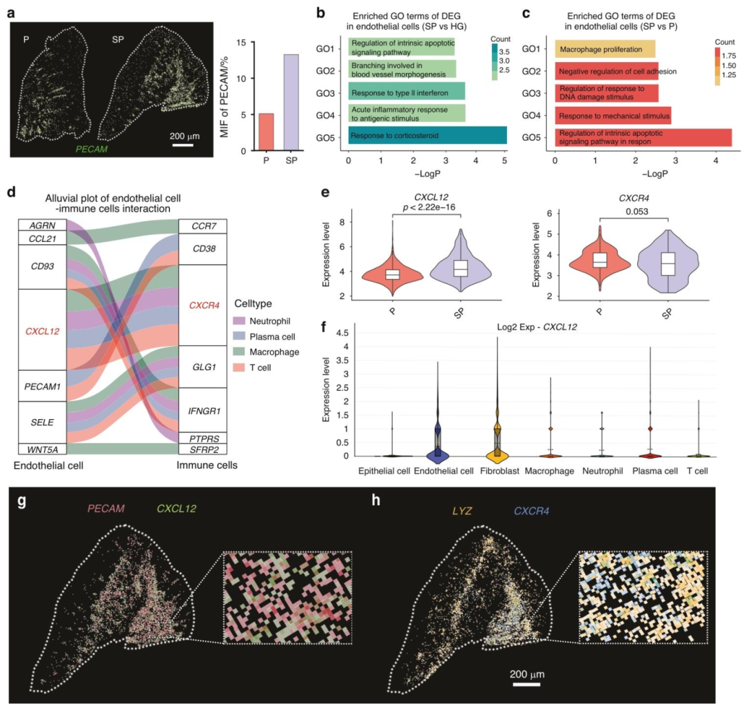 图 5：内皮细胞炎症及其与巨噬细胞的相互作用加剧吸烟相关牙周炎