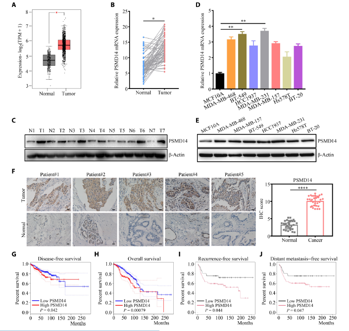 图 1 PSMD14 在三阴性乳腺癌(TNBC)中呈上调表达，且与不良预后相关