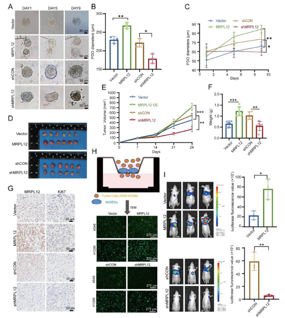 图 4 MRPL12 促进肺腺癌肿瘤发生