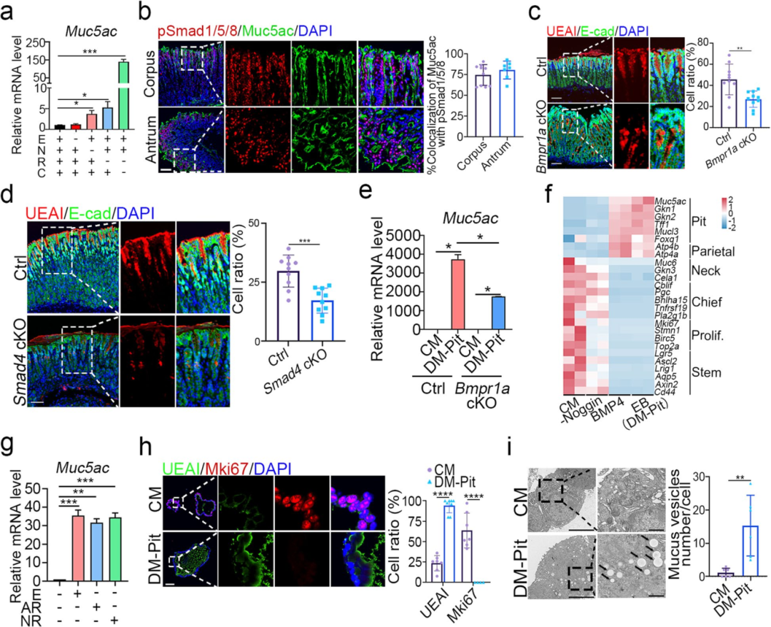 4，表面黏液细胞分化受BMP4和EGF信号增强。