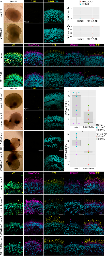 图1显示RDH12-AD及对照视网膜类器官分化18周和44周时免疫荧光染色结果。