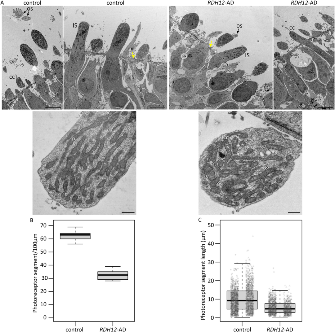 图2通过透射电子显微镜对37周的RDH12-AD和对照组视网膜类器官进行超微结构分析。