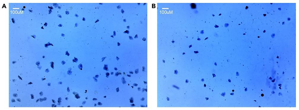 图 3:颊细胞形态与健康状态的台盼蓝染色成像