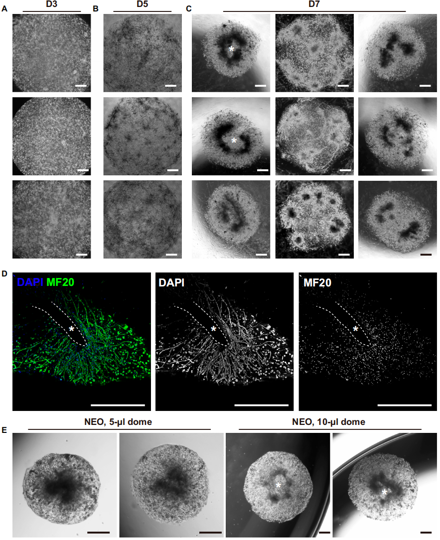 3) 肌肉分化和肌纤维类型恢复。