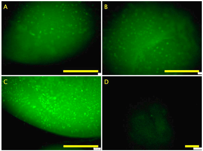 4) 矿化分析和骨标志物表达