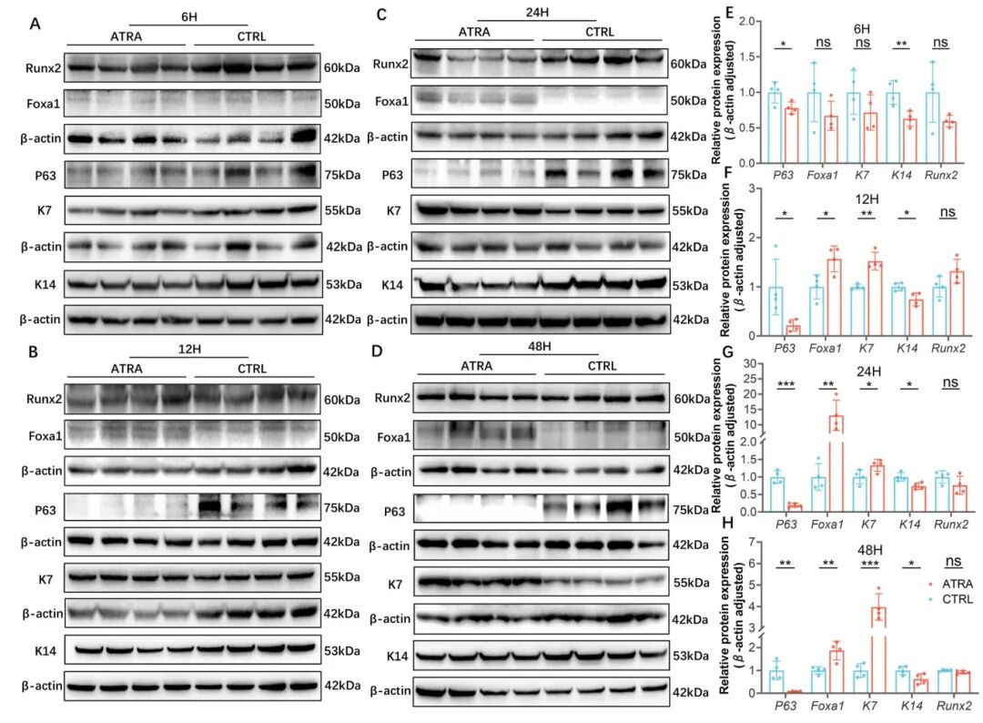 图2 ATAR诱导后2d培养结膜上皮细胞的蛋白表达分析