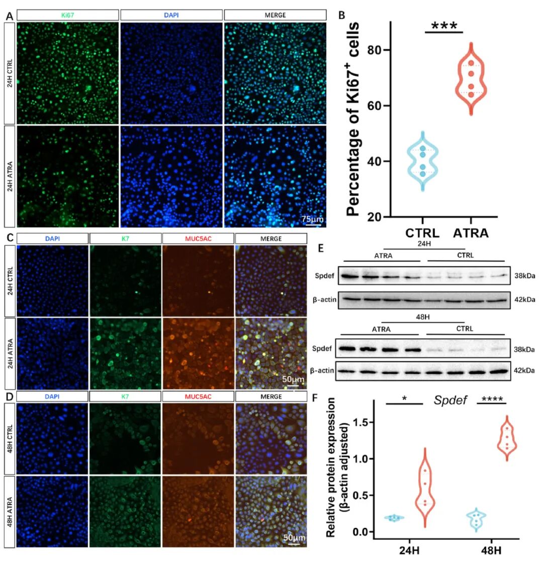 图3 ATRA诱导后不同时间点结膜上皮标志物的变化