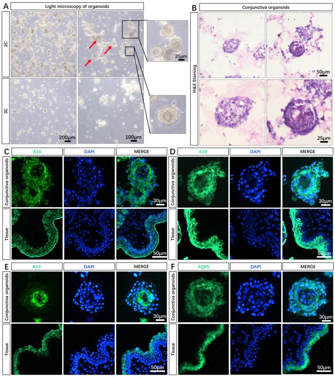 图4 结膜类器官模型的建立与验证