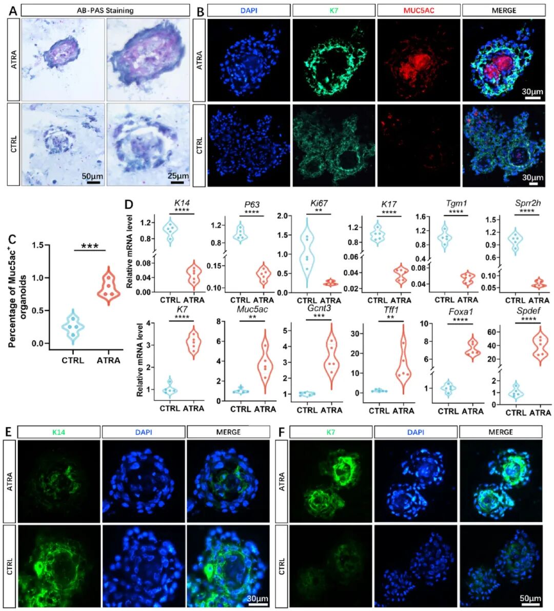 图5 利用新型3D小鼠结膜类器官模型研究视黄酸的分化作用