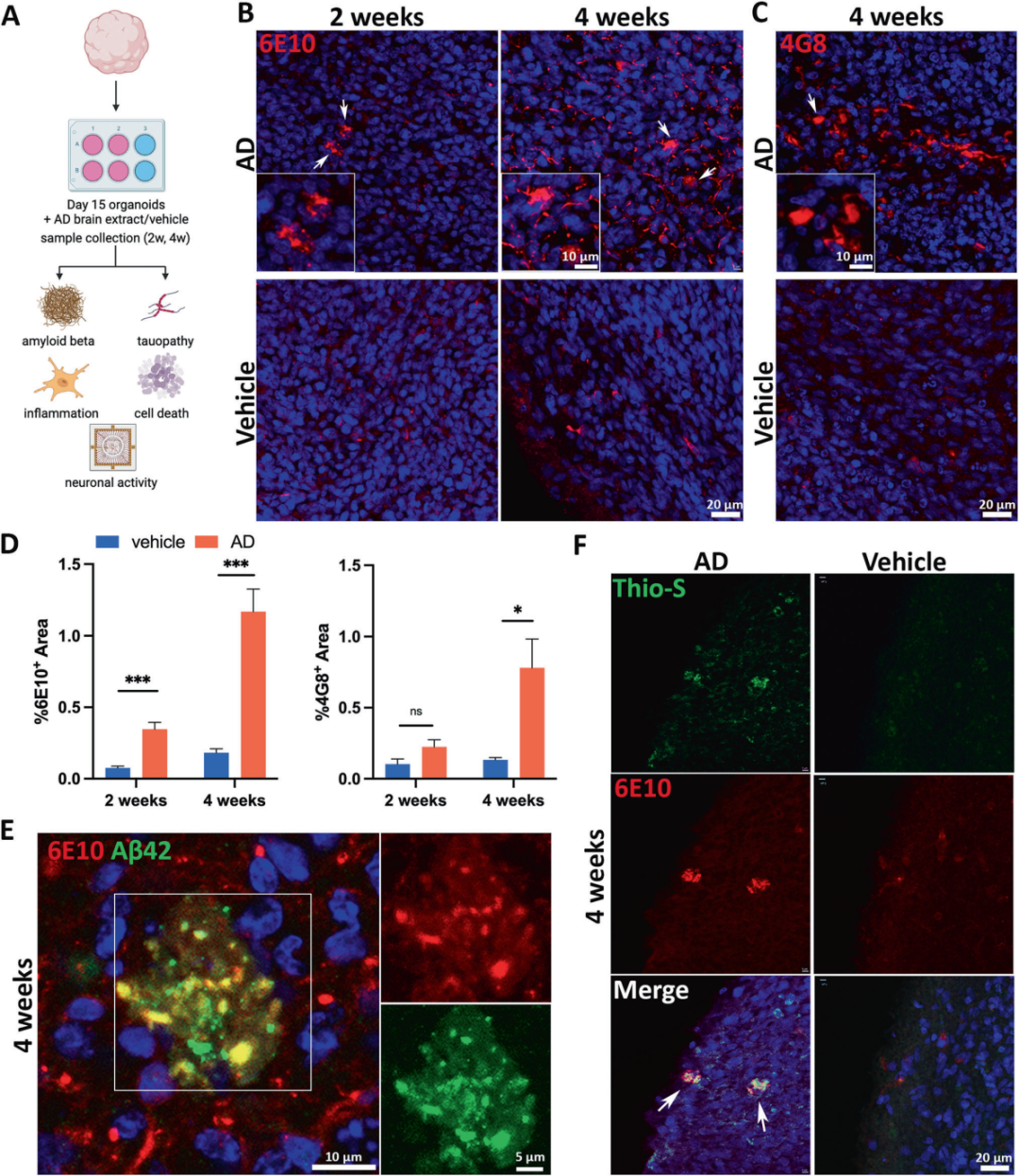 图2展示了散发性AD患者脑提取物在类器官中诱导Aβ病理的过程。