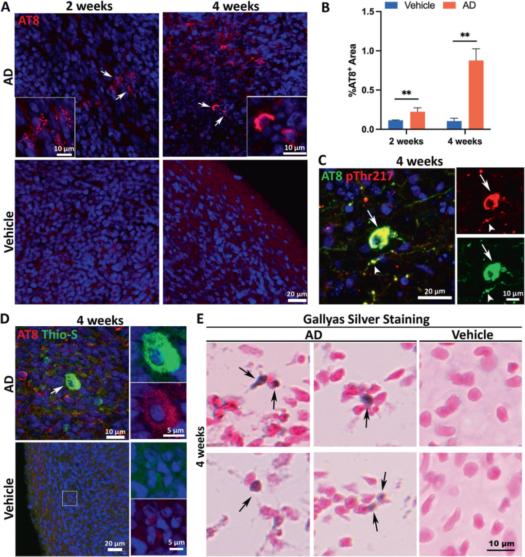图3展示了散发性AD患者脑提取物在类器官中诱导tau病理的过程。