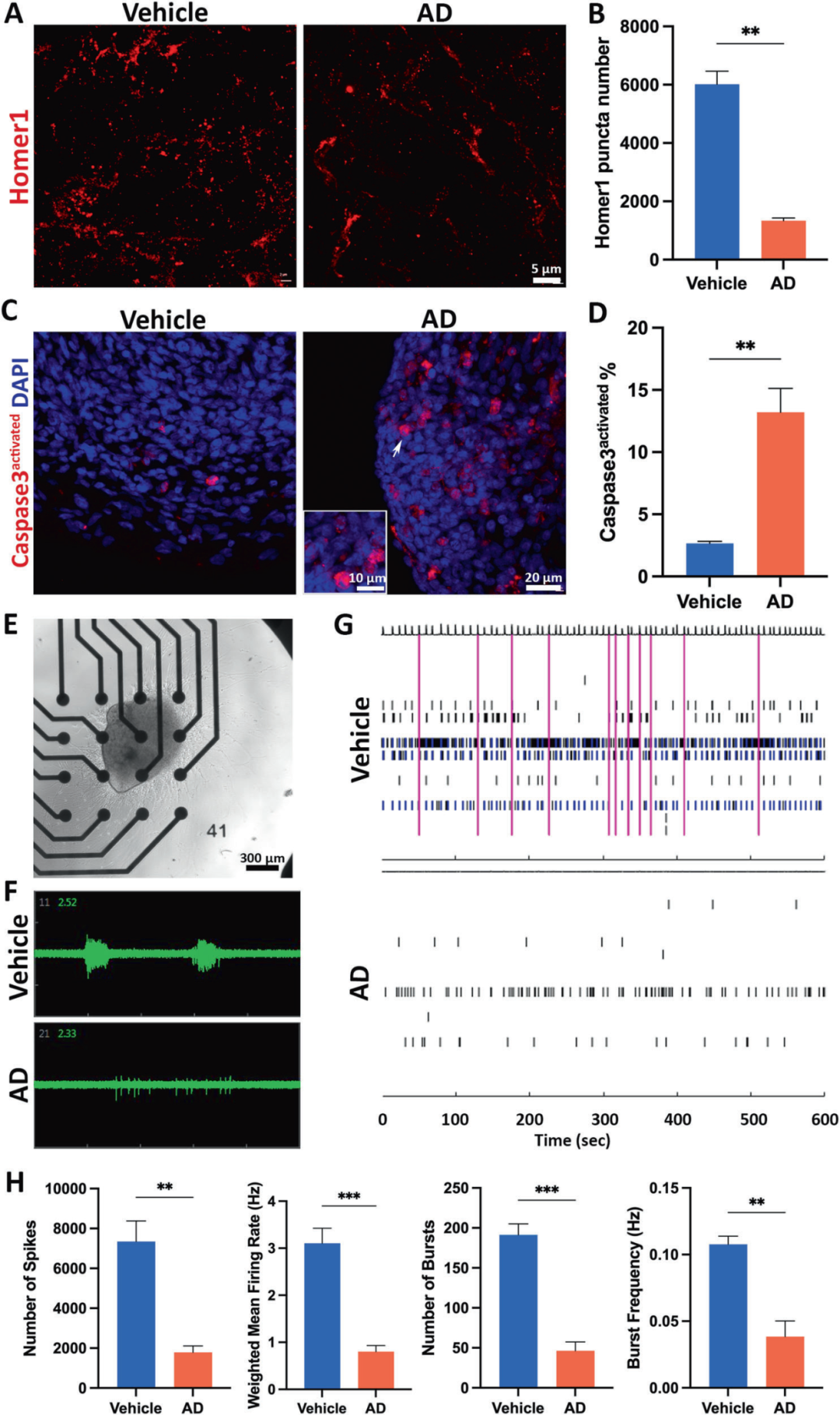 图5展示了AD神经免疫类器官复现突触/神经元损失和神经网络活动受损的过程。