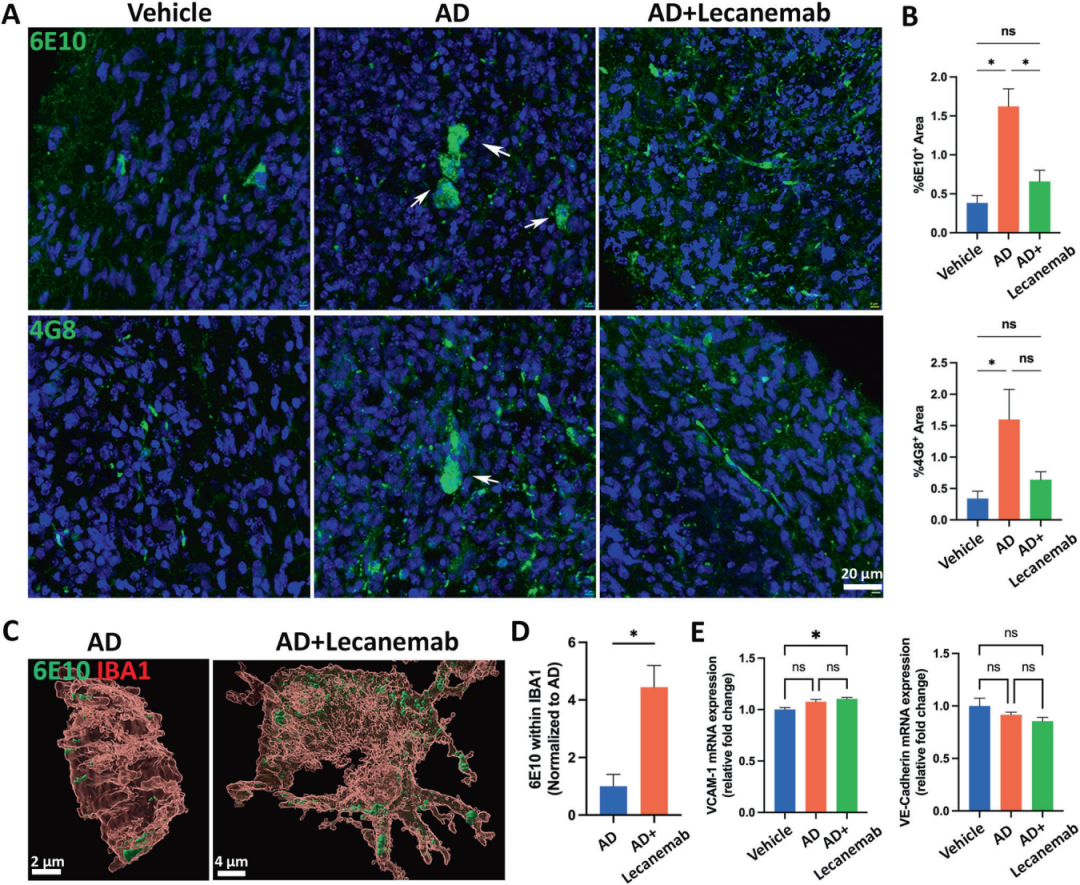 图7展示了抗Aβ抗体Lecanemab在AD神经免疫类器官中的应用。