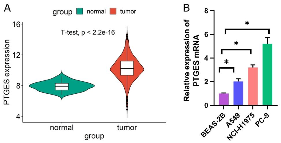 图 1：PTGES 在 LUAD 中高表达