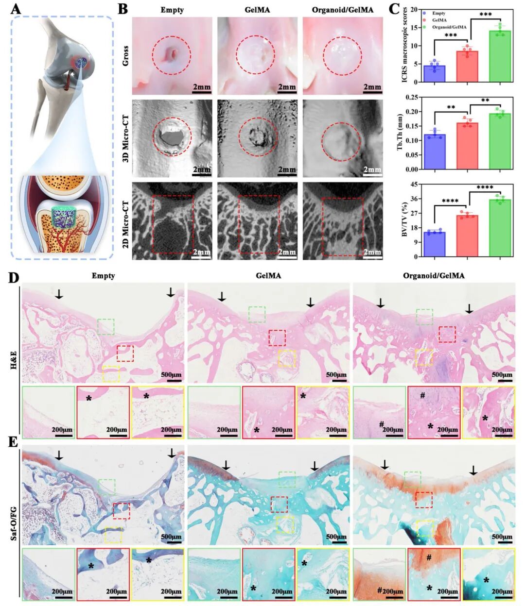 图6 在兔OCD模式下,由梯度血管微环境引导的类器官/凝胶MA圆柱梯度异质性骨软骨再生