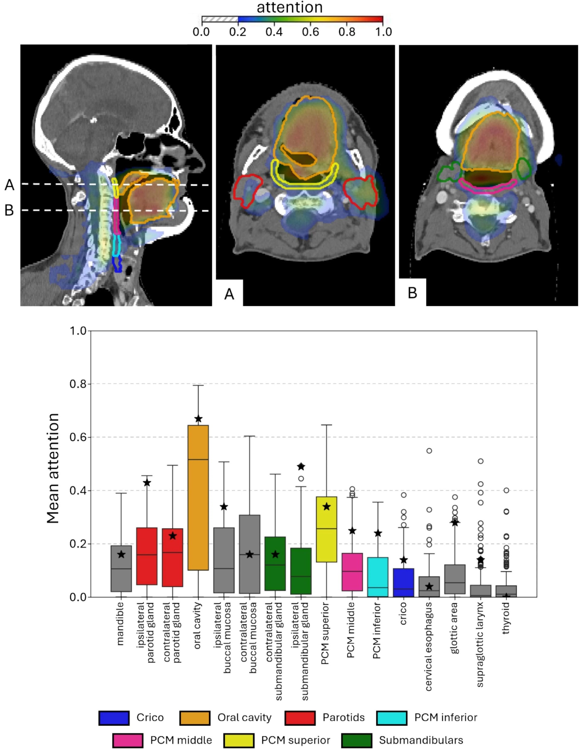 图3:RAD患者吞咽关键区域及保护依据