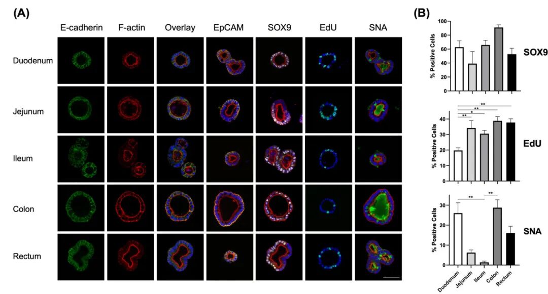 图2 新生牛肠类器官的免疫荧光染色