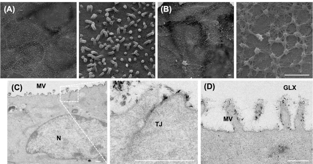 图5 直肠类器官衍生的二维单层的电子显微镜表征