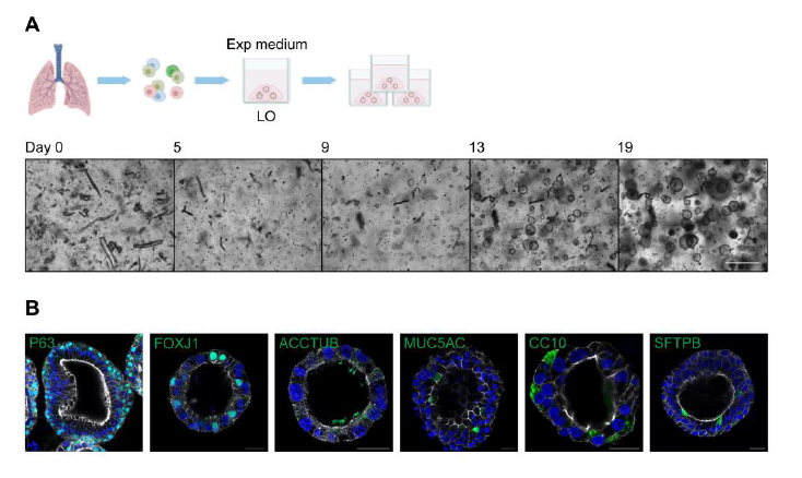 图 2 肺类器官的获取与扩增