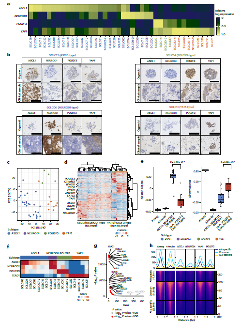 图 3 小细胞肺癌(SCLC)类器官的转录组和表观基因组特征分析