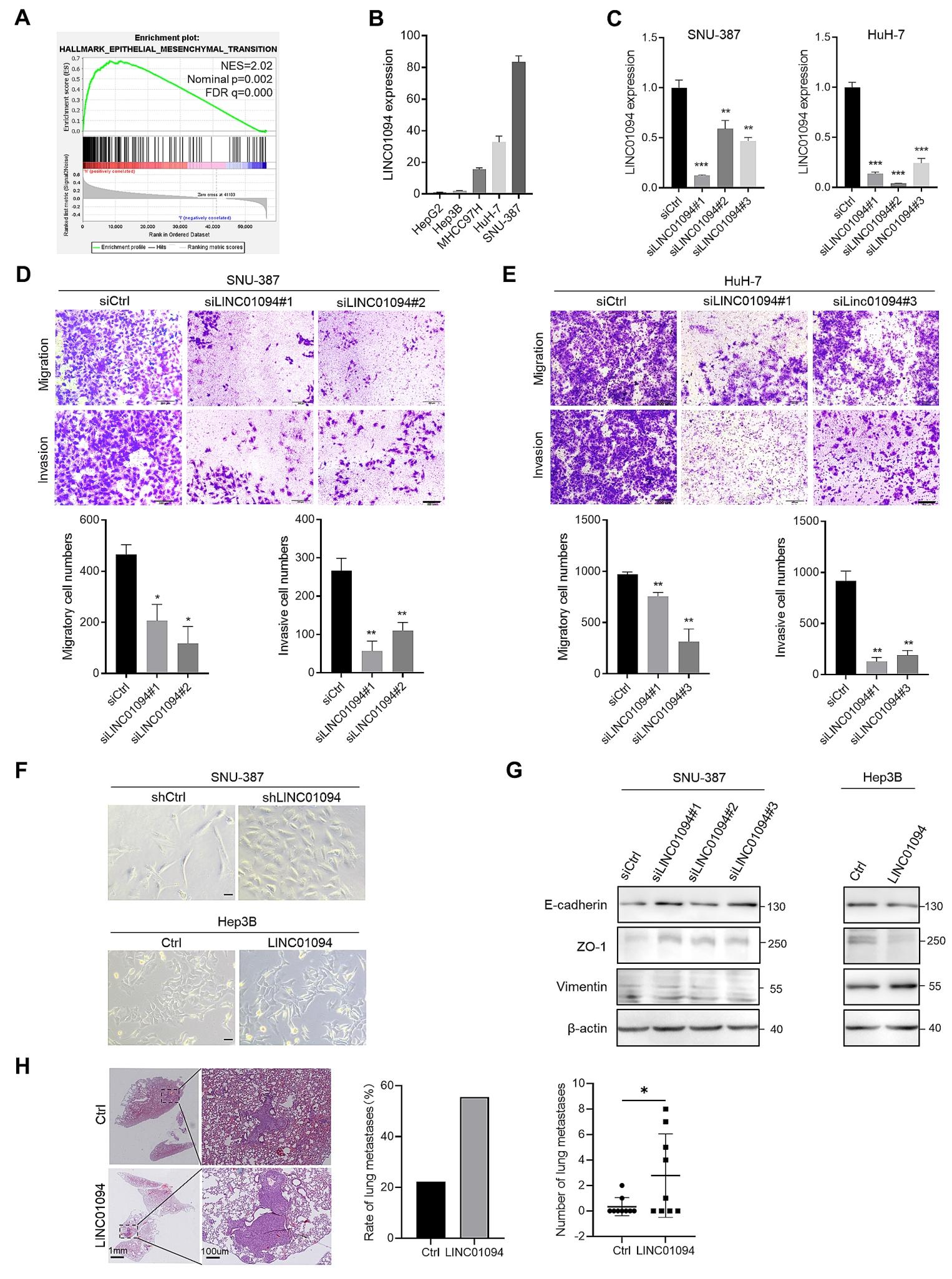 图2：LINC01094 促进 HCC 细胞迁移、侵袭及 EMT