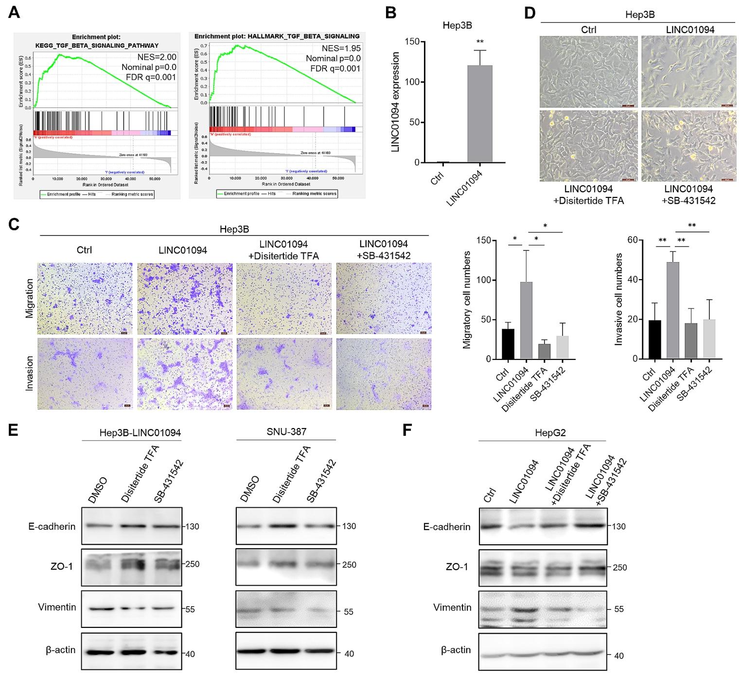 图3：LINC01094 通过 TGF-β/SMAD 通路促进 EMT
