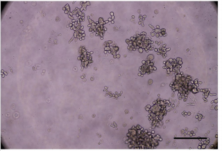 ICC-X3人肝内胆管癌细胞肿瘤球形成试验图