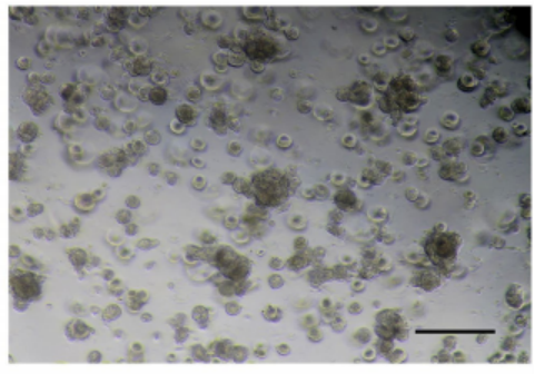 ICC-X3人肝内胆管癌细胞类器官培养图