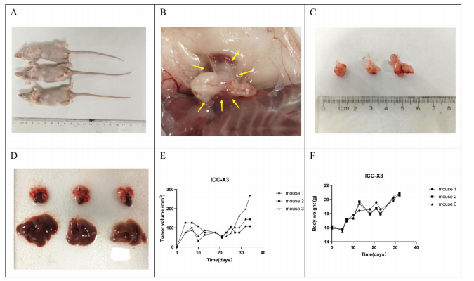 ICC-X3人肝内胆管癌细胞BALB/C裸鼠中的致瘤性图
