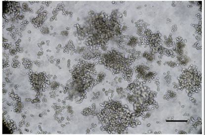 ICC-X2人肝内胆管癌细胞球体形成试验图