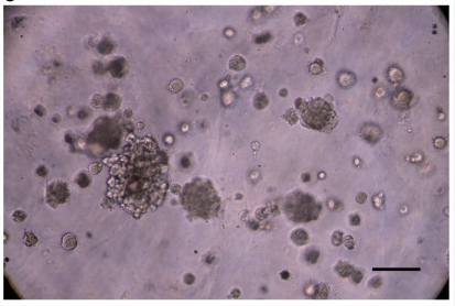 ICC-X2人肝内胆管癌细胞类器官培养图