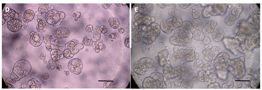 DPC-X1人混合型壶腹癌细胞器官培养图
