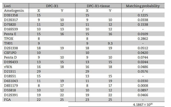 DPC-X1人混合型壶腹癌细胞STR鉴定图