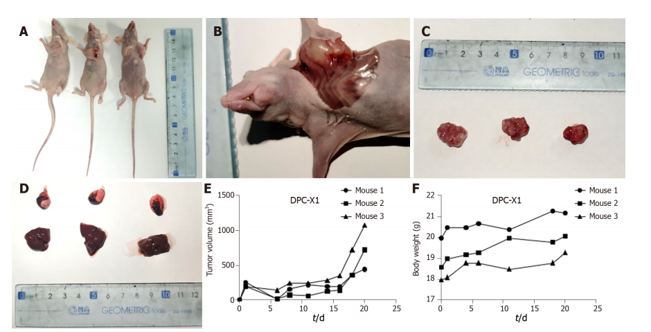 DPC-X1人混合型壶腹癌细胞裸鼠异种移植物肿瘤图