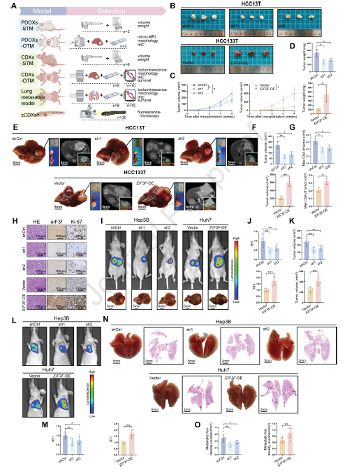 图 2 升高的真核起始因子 3 亚基 f(eIF3f)水平在体外和体内都会促进肝细胞癌(HCC)的恶性发展