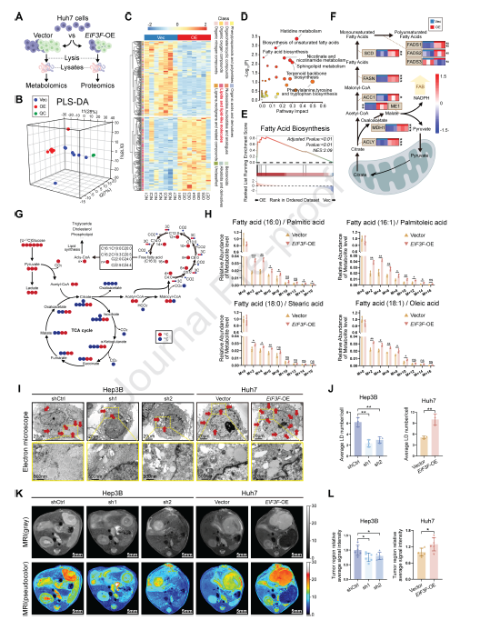 图 3 真核起始因子 3 亚基 f(eIF3f)增强了肝细胞癌(HCC)中的脂肪酸生物合成和脂质积累