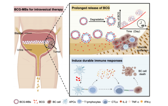 图1：展示BCG微球体(BCG-MBs)在膀胱内免疫治疗应用的示意图