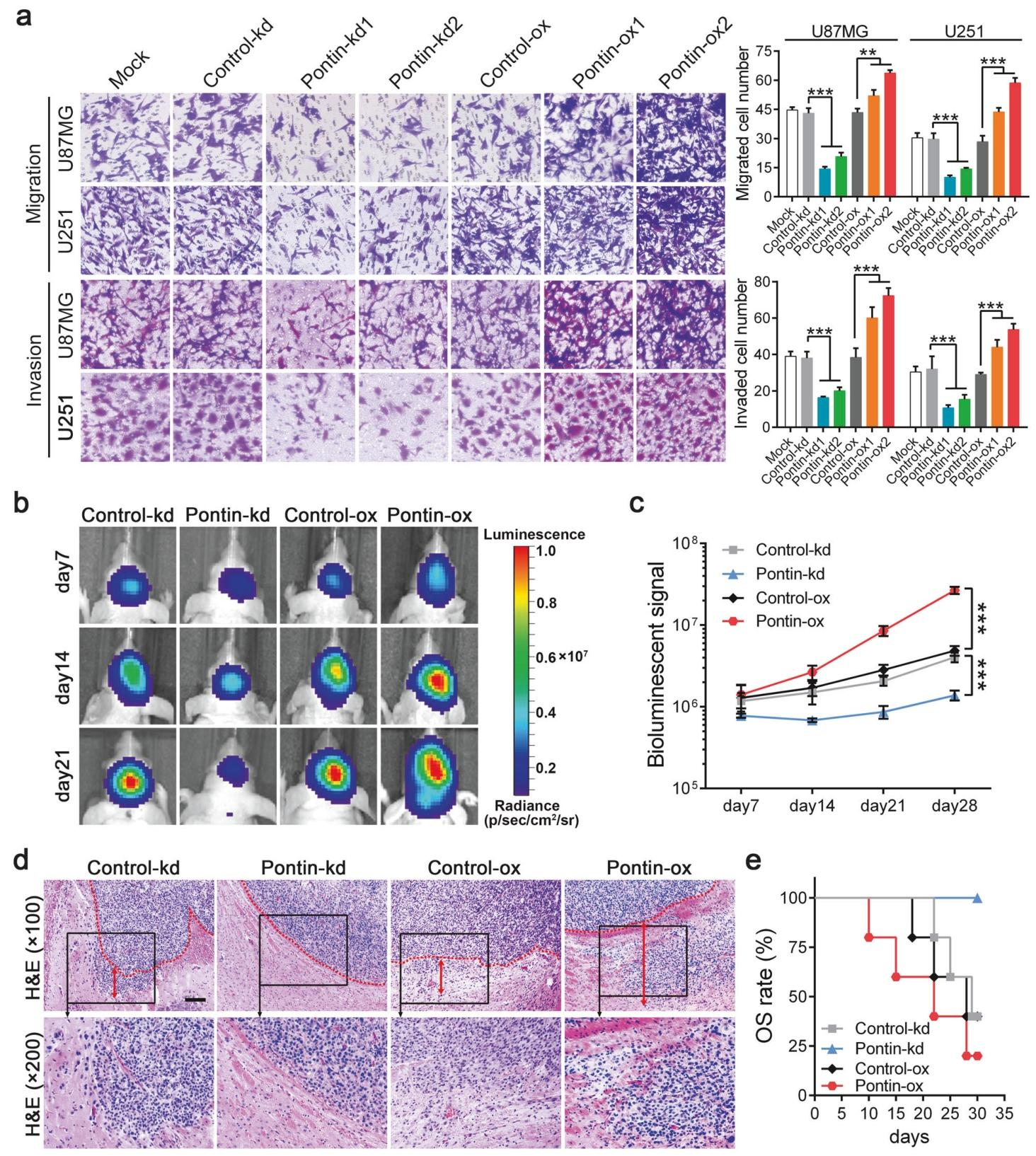 图3：Pontin 增强 GBM 细胞迁移、侵袭能力及体内致瘤性