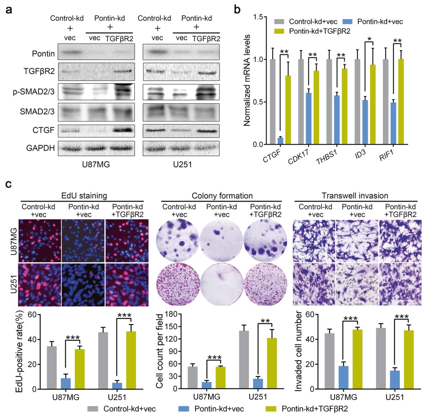 图7：TGFβR2 介导 Pontin 诱导的 GBM 恶性表型